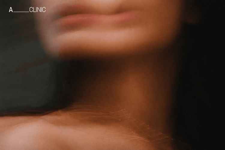 Связь акне и ЖКТ: что говорят исследования?