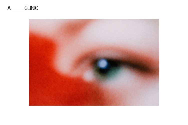 Резус-аллоиммунизация при беременности