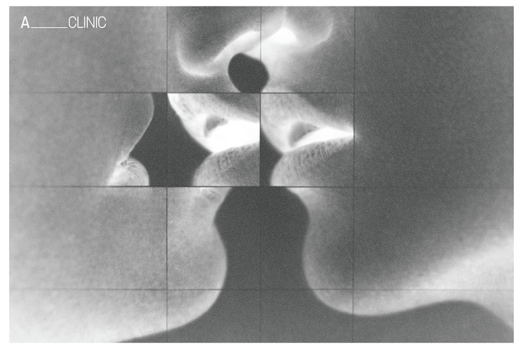 Что делать после незащищённого контакта и куда обращаться в Тбилиси